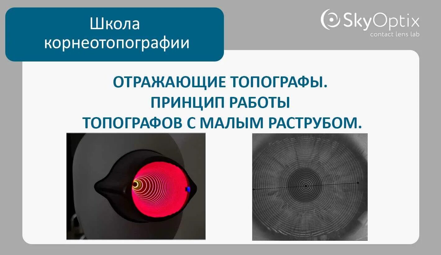 Skyoptix линзы. Корнеотопография. карты корнеотопографии. skyoptix. рябенко skyoptix.