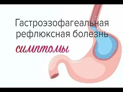 Витамины при гэрб