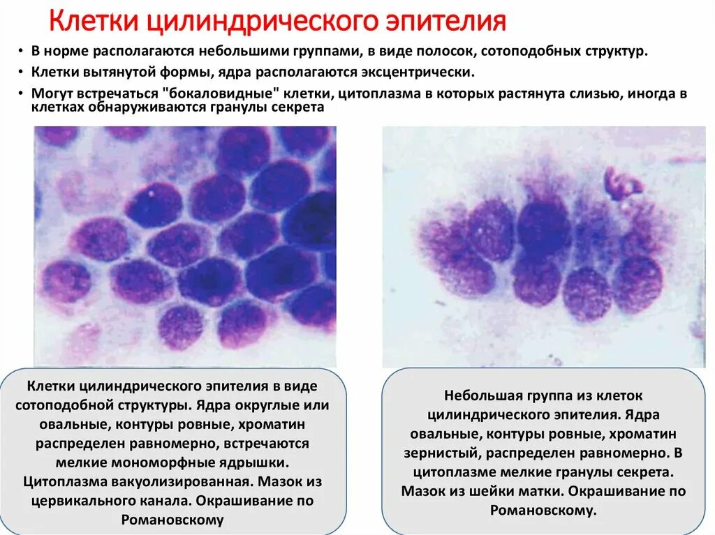 Часть клеток с реактивными изменениями. Цилиндрический эпителий шейки матки цитограмма. Пролиферации железистого эпителия цитология. Пролиферация плоского эпителия. Железистый эпителий в цитологии.