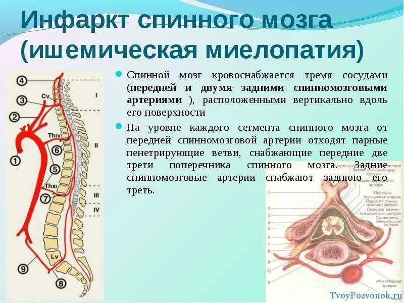 Боль в спинном мозге. Вертеброгенная шейная миелопатия. Миелопатия шейного отдела позвоночника неврология. Спинальная миелопатия. Миелопатии спинного мозга.