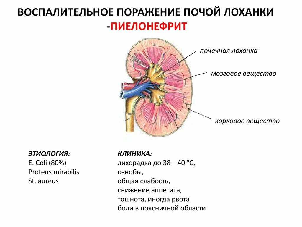 Что значит лоханка расширена. Лоханка почки. Почечная лоханка. Расширение лоханки почки. Расположение лоханки почки.