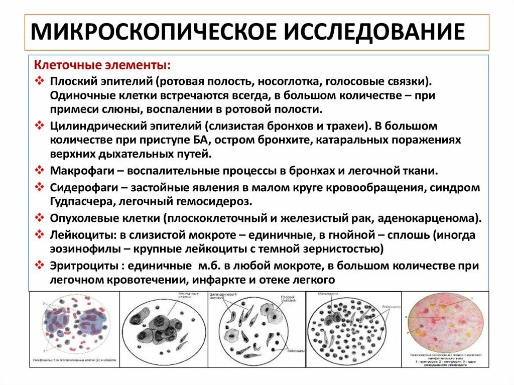 Мокрота при инфекции. Эозинофилы в мокроте микроскопия. Мокрота нативный препарат микроскопия. Микроскопический метод исследования микозов. Микроскопия мокроты атлас.