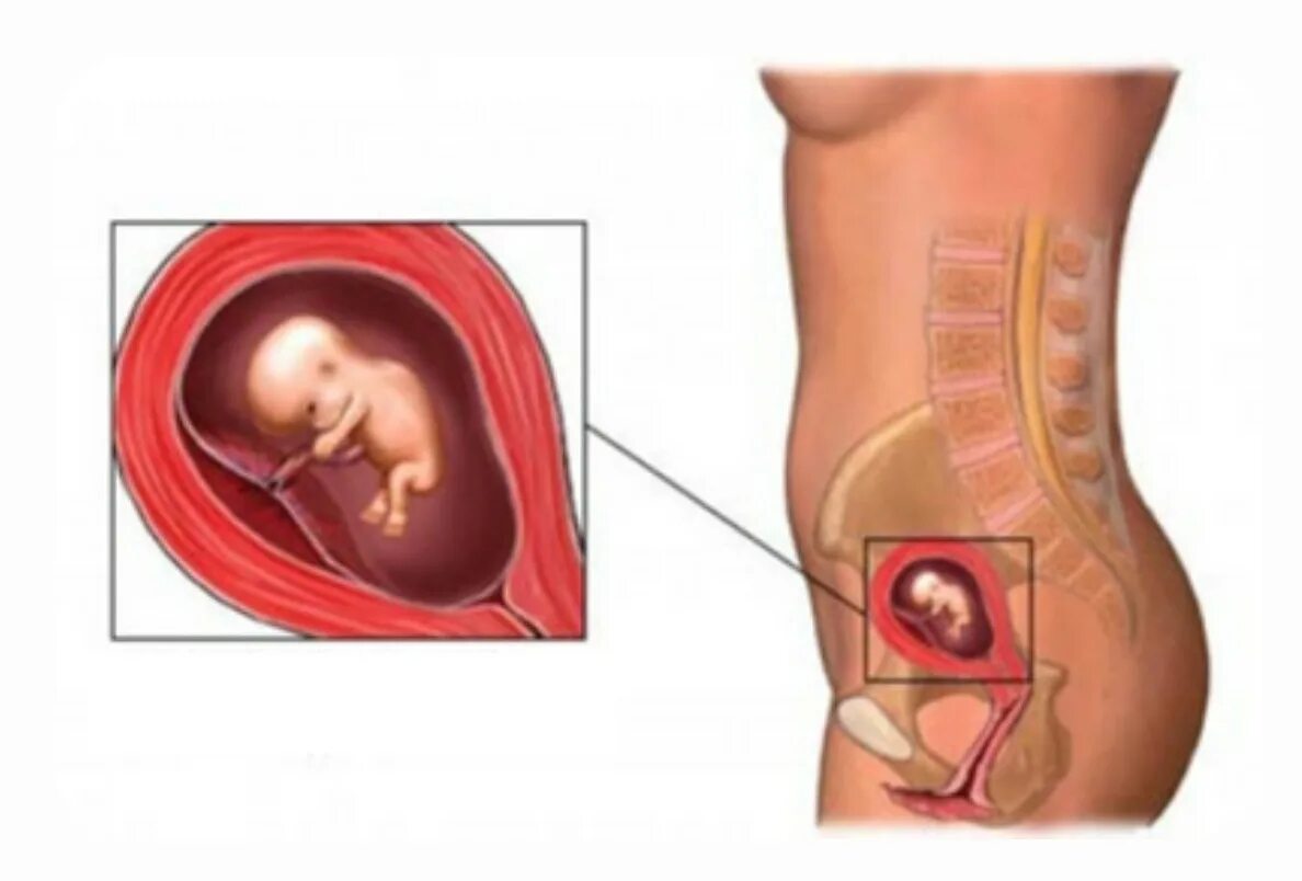 Беременность первого триместра форум. Анатомия беременной 1 триместр. Расположение ребенка на 9 месяце. Плод в первом триместре. Расположение плода первый триместр беременности.