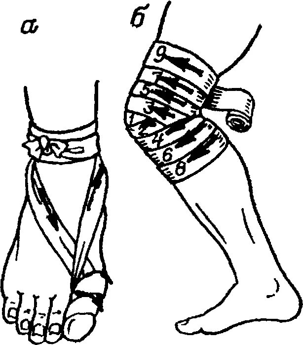 Эластичное бинтование нижних конечностей. Бинтование эластичным бинтом верхней конечности. Бинтование коленного сустава эластичным бинтом. Бинтование голеностопа эластичным бинтом. Эластичное бинтование ноги