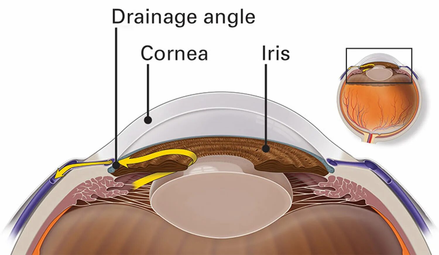 Intraocular Pressure. Циклодиализ при глаукоме. Glaucoma Drainage. Глаукома латынь