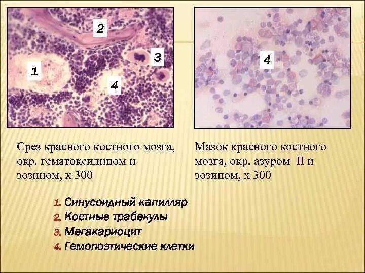 Структуры красного костного мозга. Срез красного костного мозга гистология. Срез костного мозга гистология препарат. Строение красного костного мозга гистология препарат. Срез красного костного мозга гематоксилин эозин.