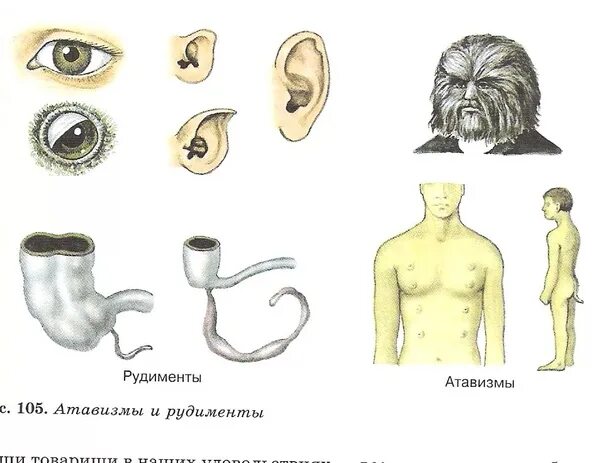 Аппендикс является рудиментом. Атавизмы и рудименты человека. Рудименты человека атавизмы человека. Рудименты доказательства эволюции. Рудименты и атавизмы хвост у человека.