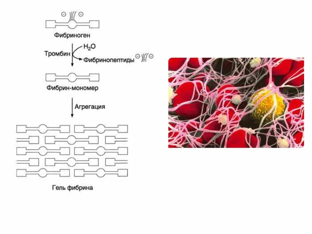 Как изменится количество фибрина после пореза. Тромбин фибриноген фибрин. Превращение фибриногена в фибрин. Схема процесса образования фибрина в крови. Схему «стадии перехода фибриногена в фибрин».