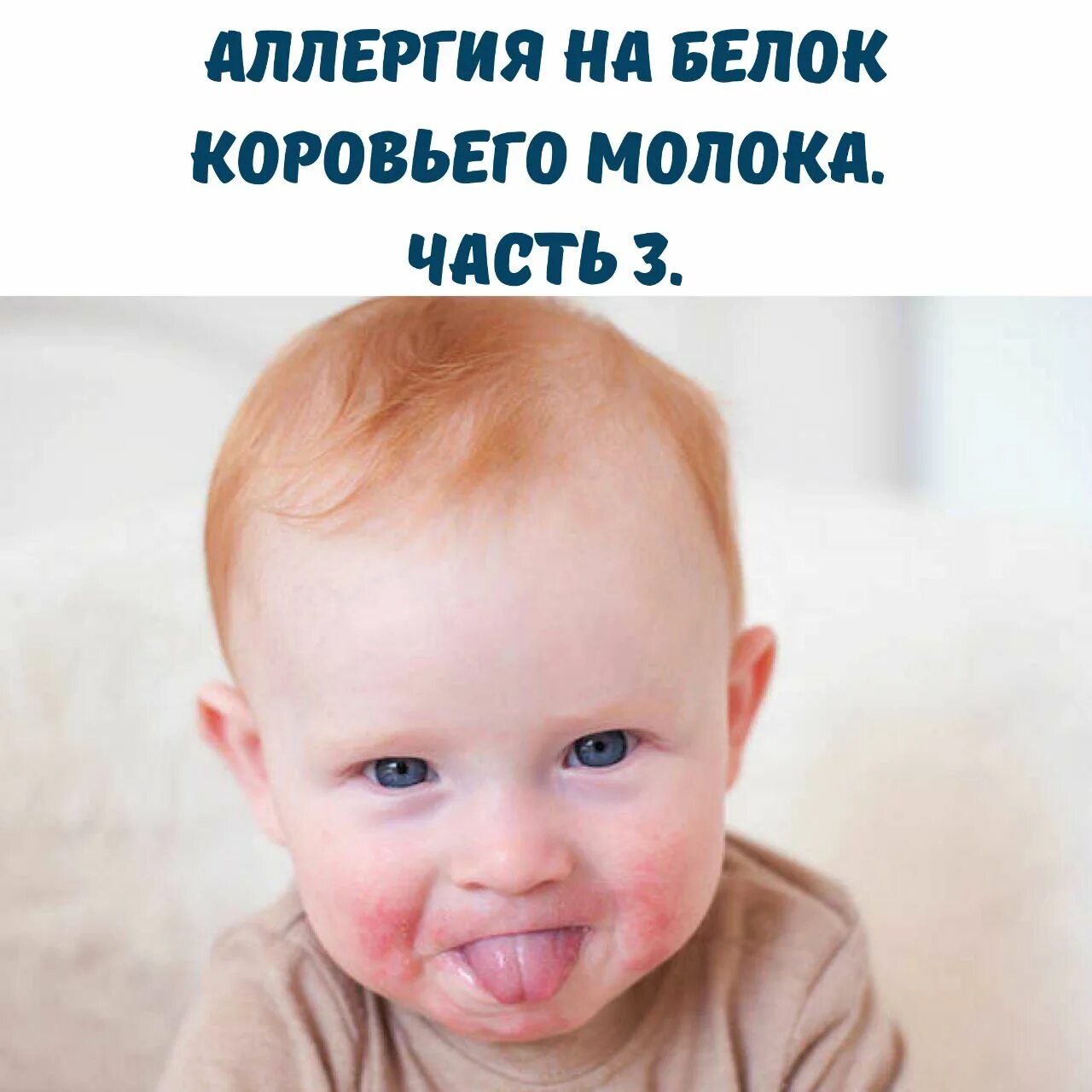 Непереносимость белка коровьего молока у детей. Непереносимость белка коровьего молока у детей
