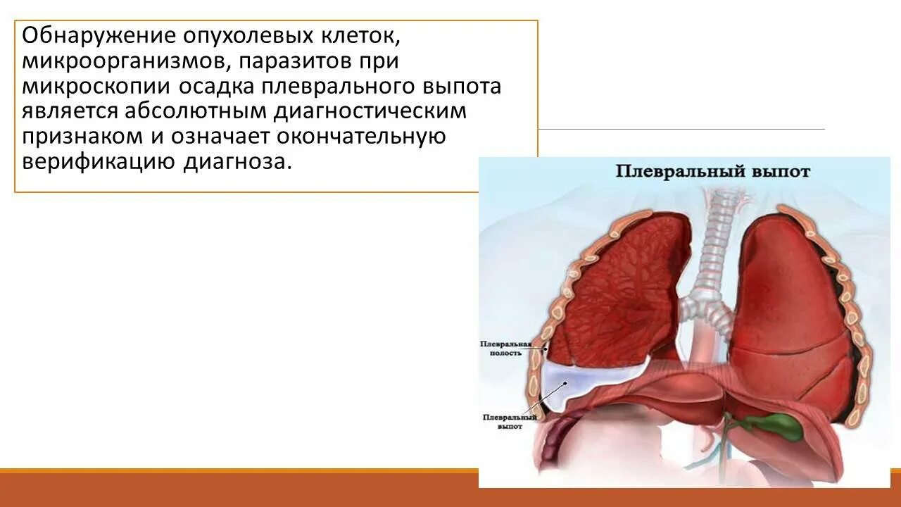 Плевральный выпот транссудат. Дифференциальная диагностика плеврального выпота. Диф диагностика при выпоте в плевральную полость. Транссудат в плевральной полости. Плевральный транссудат