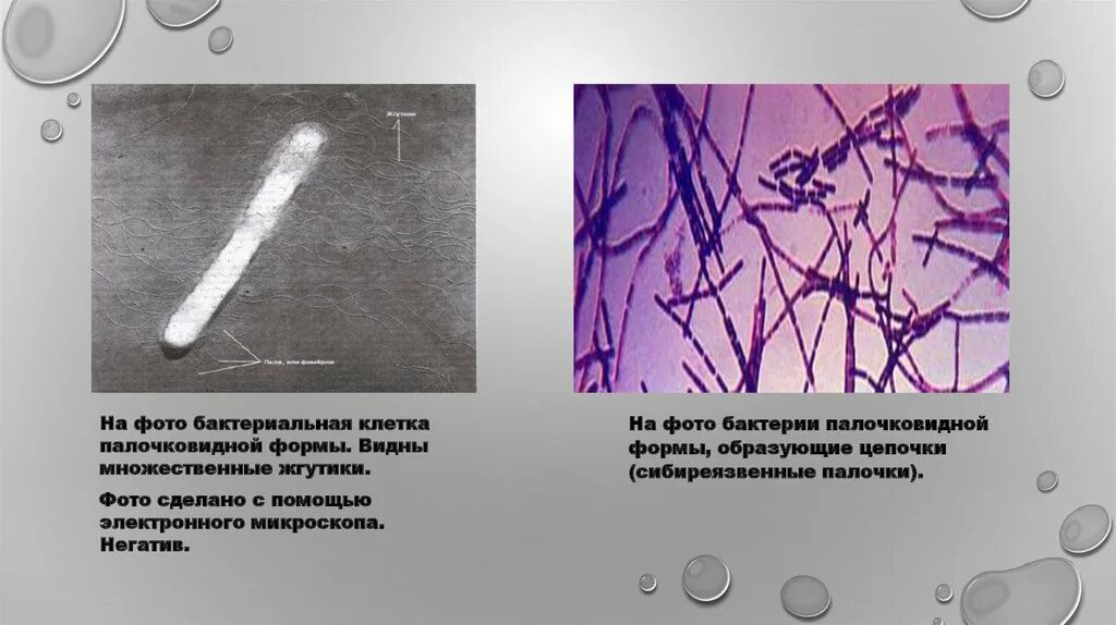 Образуют видимой формой. Палочковидные формы бактерий. А) формы палочковидных клеток бактерий. Жгутики бактерий микроскоп. Палочкой видные бактерии.