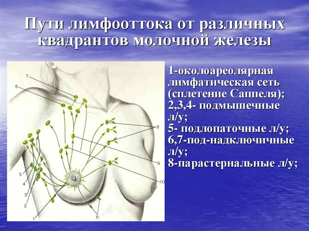 Лимфоотток от молочной железы узлы Зоргиуса. Аксиллярные и регионарные лимфоузлы. Схема оттока лимфы от молочной железы. Лимфатическая система молочной железы пути оттока. Лимфоузлы при рмж