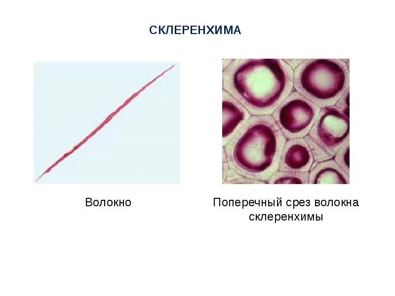 Сильно развиты механические ткани листа