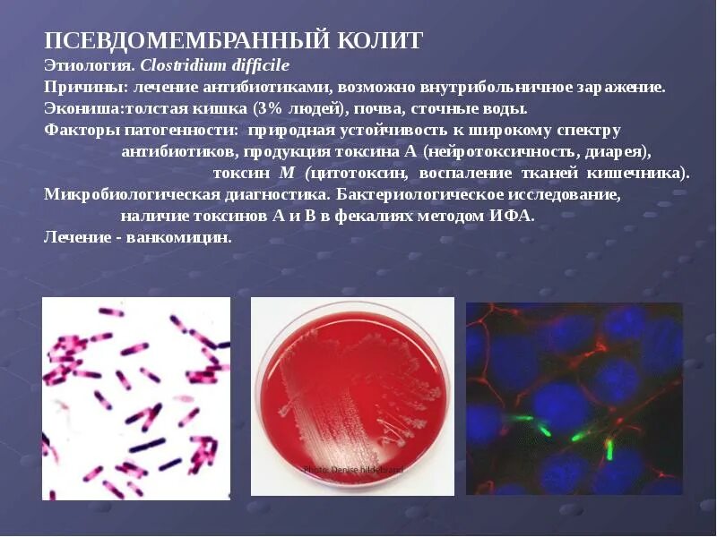 Клостридия диффициле микробиология. Clostridium difficile антибиотики. Клостридиум диффициле факторы патогенности. Клостридиум микробиология.