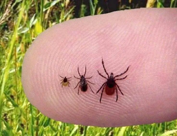 С начала сезона клещи укусили 16 жителей Марий Эл " МЭТР - Марий Эл Телерадио