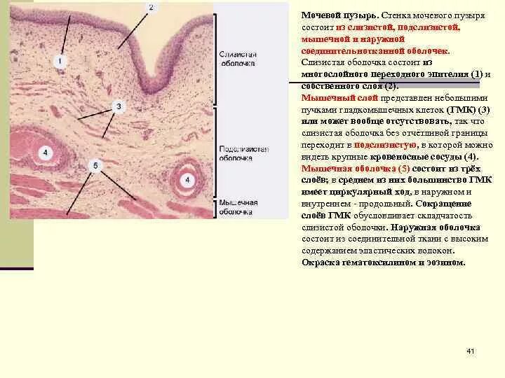 Слои переходного эпителия. Гистологический препарат мочевой пузырь. Эпителий мочевого пузыря гистология. Железы мочевого пузыря гистология. Строение стенки мочевого пузыря слои.