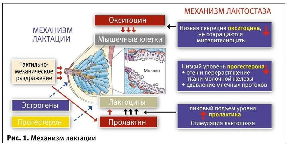 Мастит симптомы и лечение при грудном вскармливании. Лактостаз. механизм лактации. патологический лактостаз. застой в груди при грудном вскармливании.