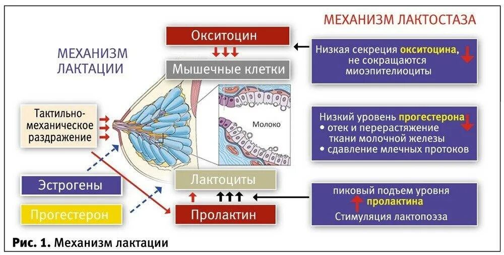 Лактостаз. Механизм лактации. Патологический лактостаз. Застой в груди при грудном вскармливании. Лактостазы у кормящей мамы