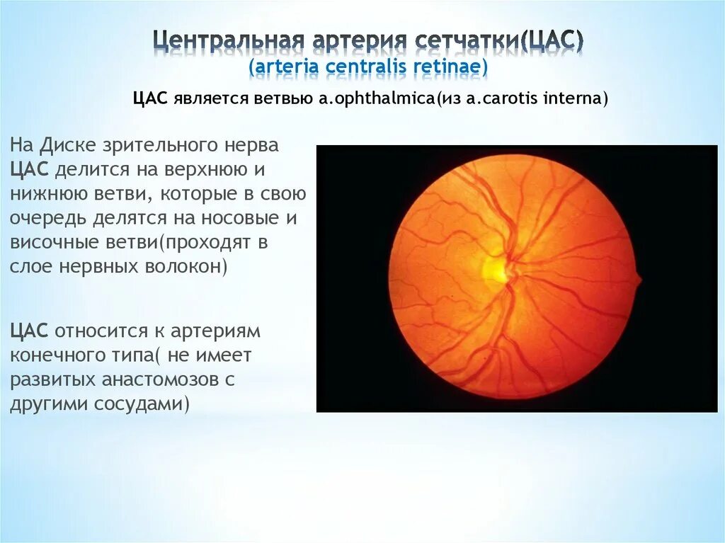Центральная артерия и Вена сетчатки. Острая непроходимость центральной артерии сетчатки (цас).. Центральная артерия сетчатки анатомия. Тромбоз центральной артерии сетчатки диагностика. Центр сетчатки