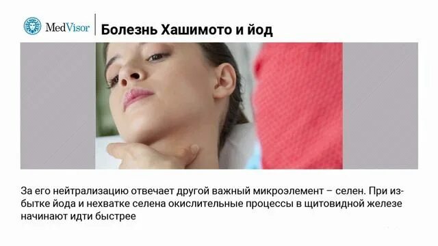 Хашимото болезнь у женщин. Болезнь Хашимото этиология.