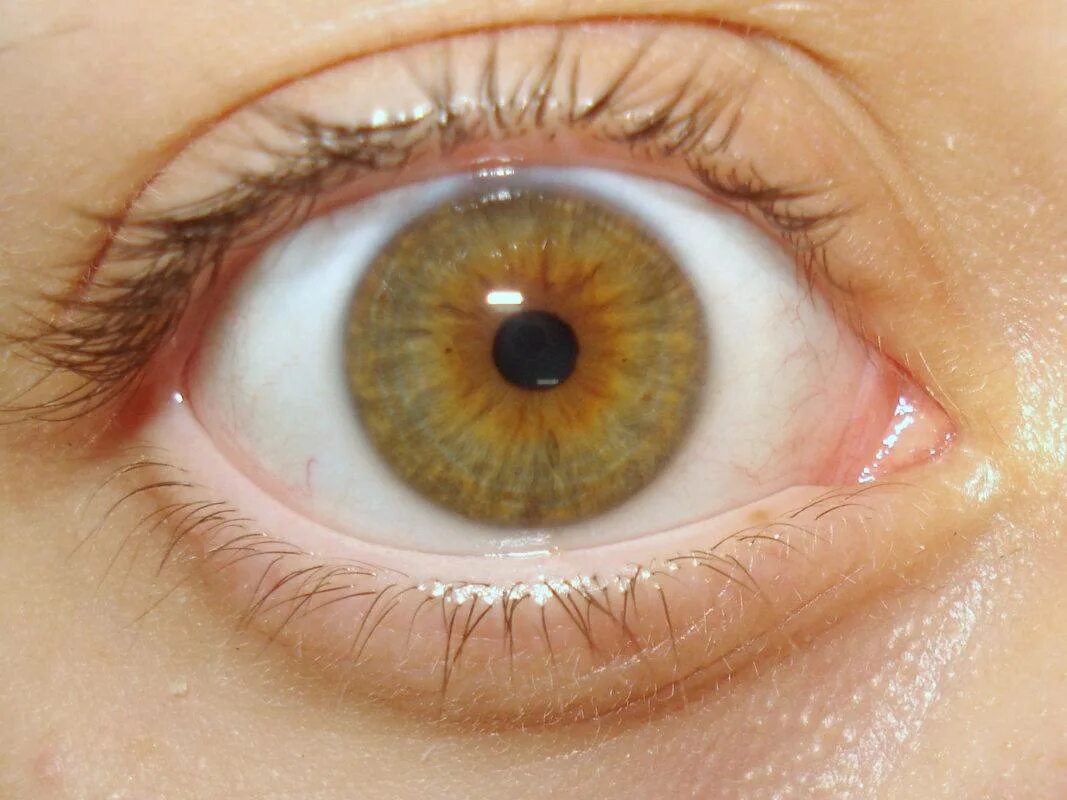 Мутно желтые глаза. Миоз мидриаз анизокория.