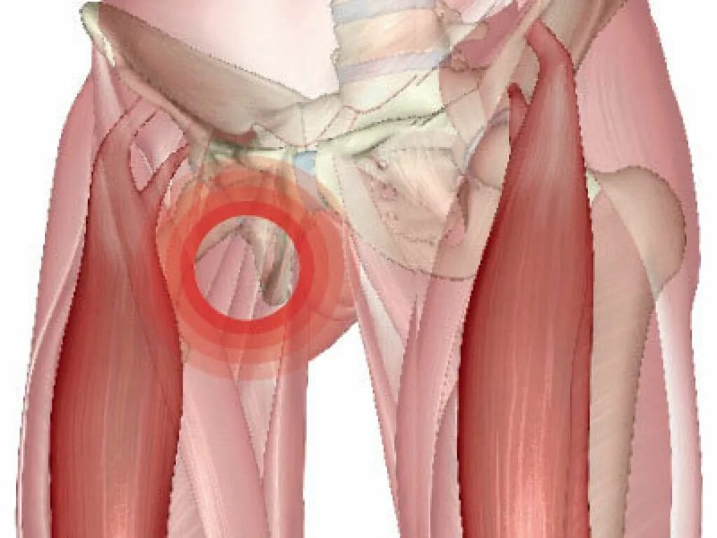 Почему пахнет между. Невенерический лимфангит. Мышцы паха. Паховые связки. Растяжение паховых мышц.