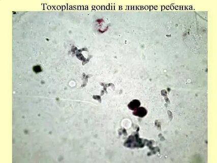 Копрограмма лямблии