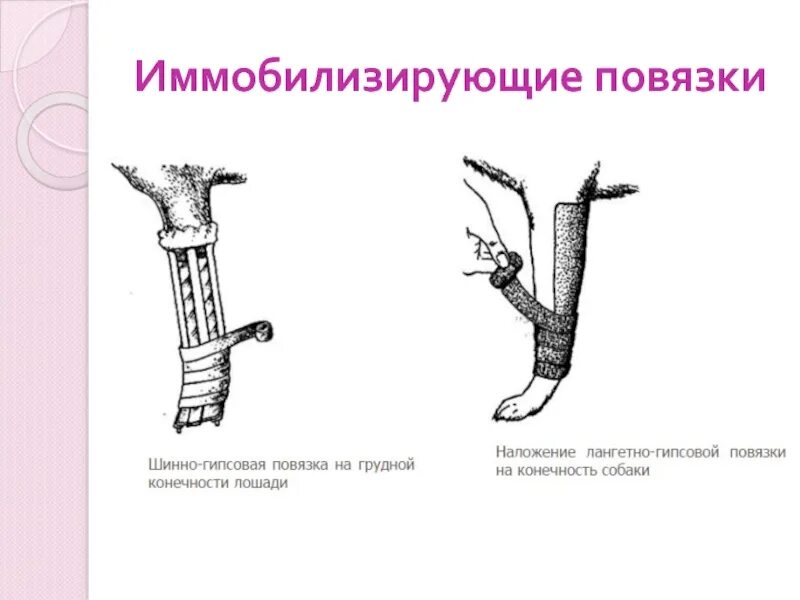 Повязка для иммобилизации шейного отдела позвоночника. Наложение иммобилизирующей повязки. Иммобилизирующая гипсовая повязка. Наложение иммобилизирующей повязки. Наложение иммобилизирующей повязки.