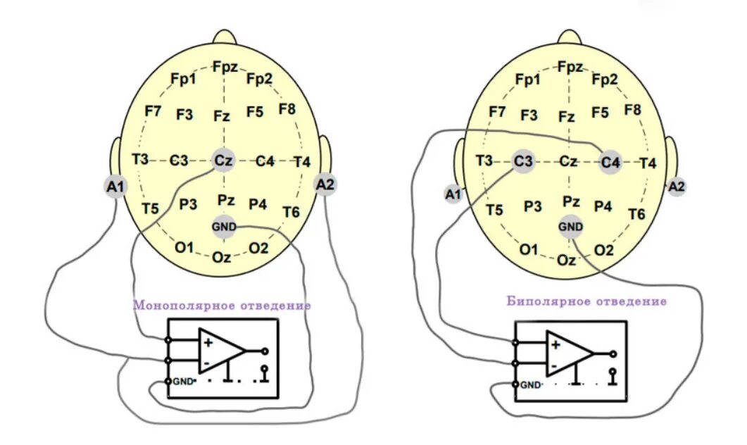 Схема расположения электродов при ЭЭГ 10-20. ЭЭГ монополярные отведения. Схема отведений ЭЭГ. Схема наложения электродов ЭЭГ.