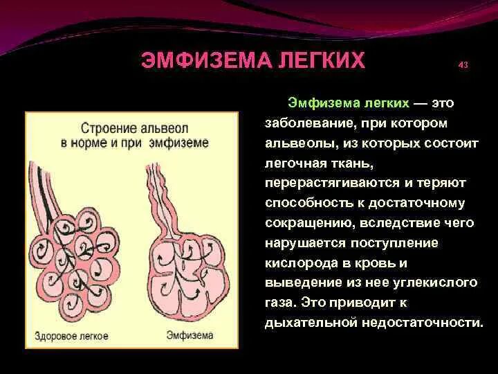 Иррегулярная эмфизема легких. Что значит легкие расширены