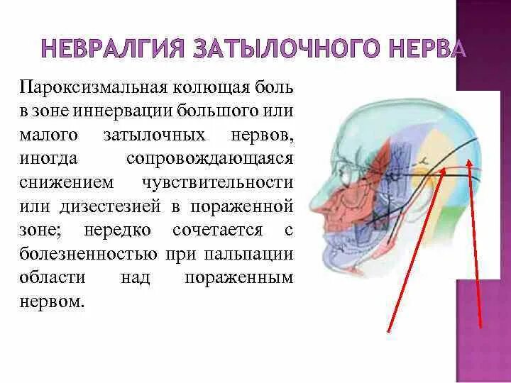 Нейропатия затылочного. Затылочный нерв анатомия схема. Невралгия затылочного нерва. Блокада большого затылочного нерва. Воспаление большого затылочного нерва.