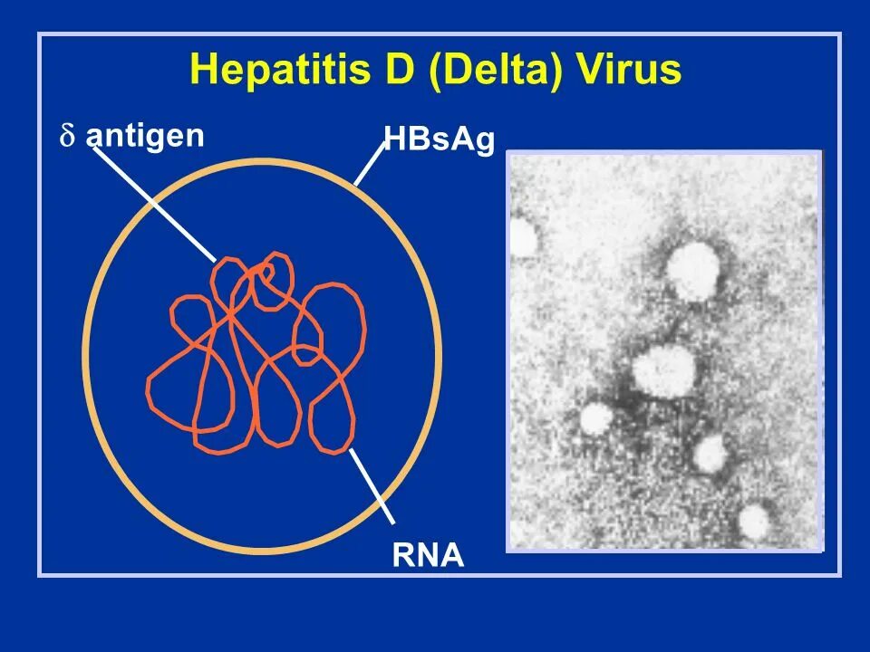 Антигены гепатита в. Hepatitis b virus антигены. Антигенная структура гепатита в. Антигенная структура вируса гепатита в. Вирус hbs.