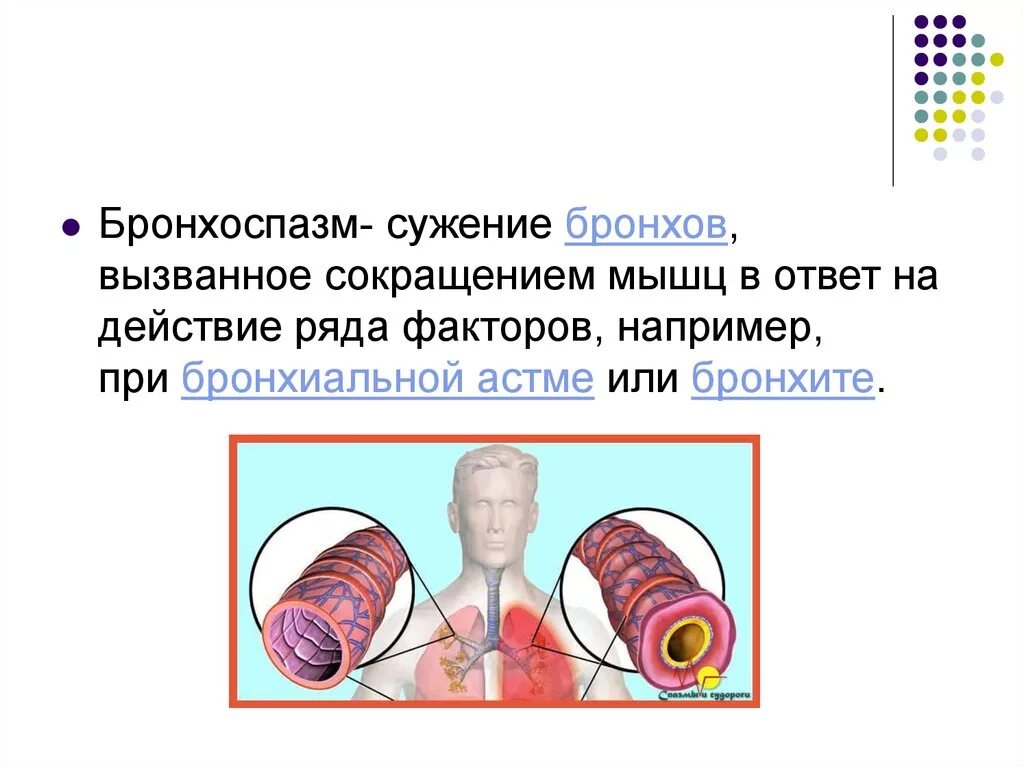 Бронхоспазм как снять быстро препараты Бронхоспазм лечение