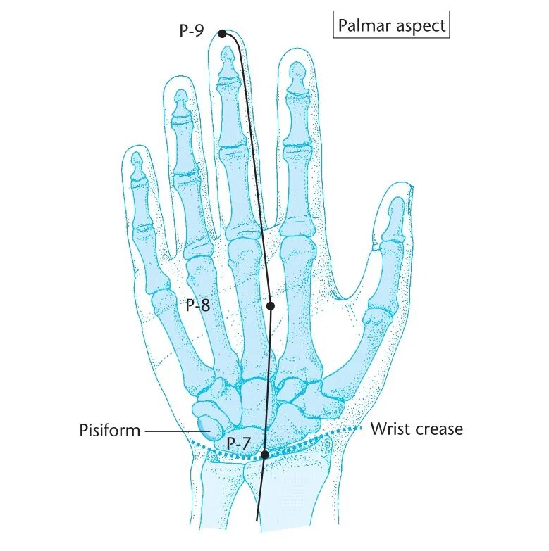 Точка мс 8. Точка Лао Гун. Точка MC.9.Чжун-Чун. Точка Лао Гун акупунктура. Точка Лао Гун на ладони.