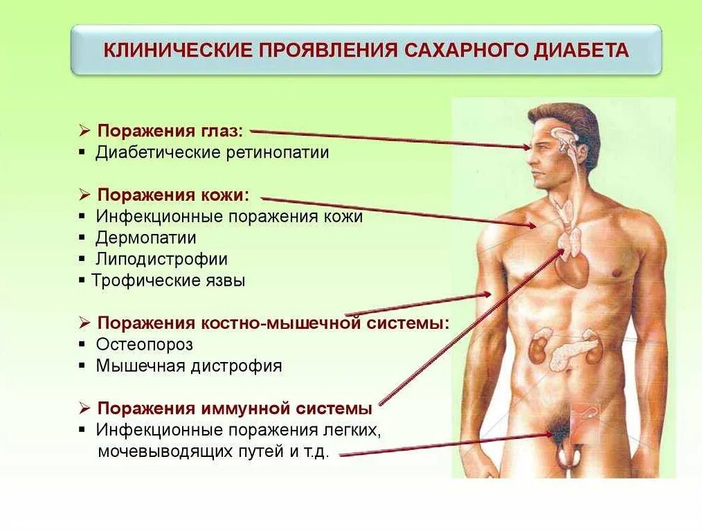 Симптомы диабета у мужчин. Сахарный диабет симптомы у мужчин. Диабет симптомы у мужчин первые. Сахарный диабет симптомы у мужчин первые признаки.