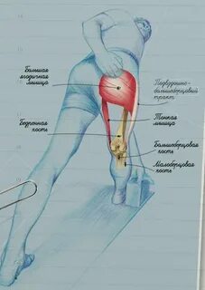 Шишка в ягодичной мышце после уколов