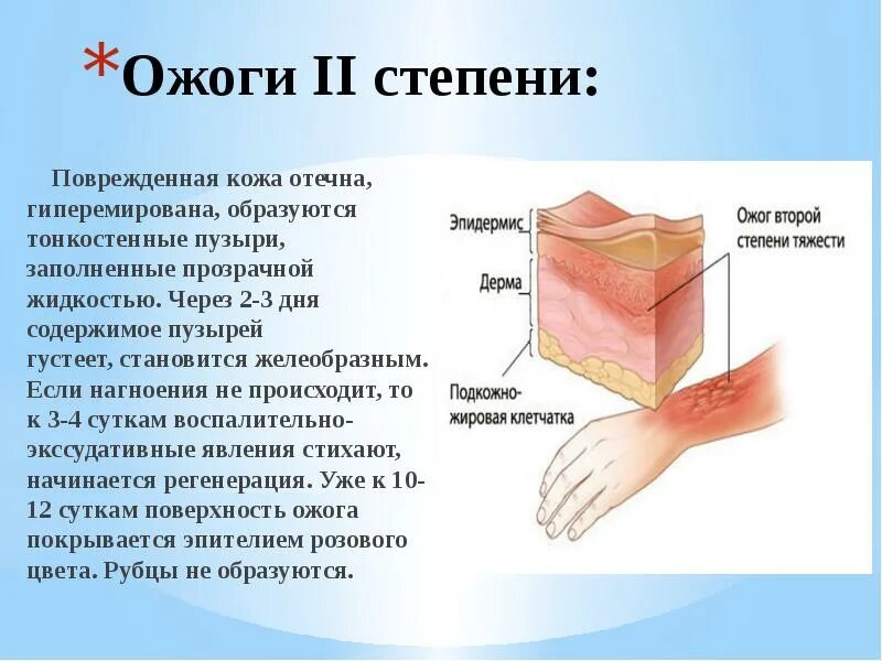 Установите соответствие степени ожога