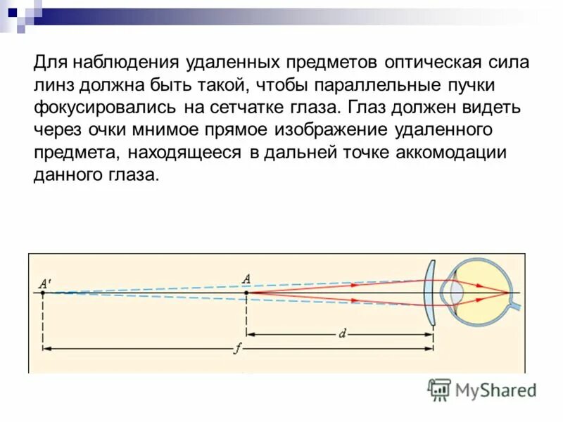 Глаз имеет оптическую силу