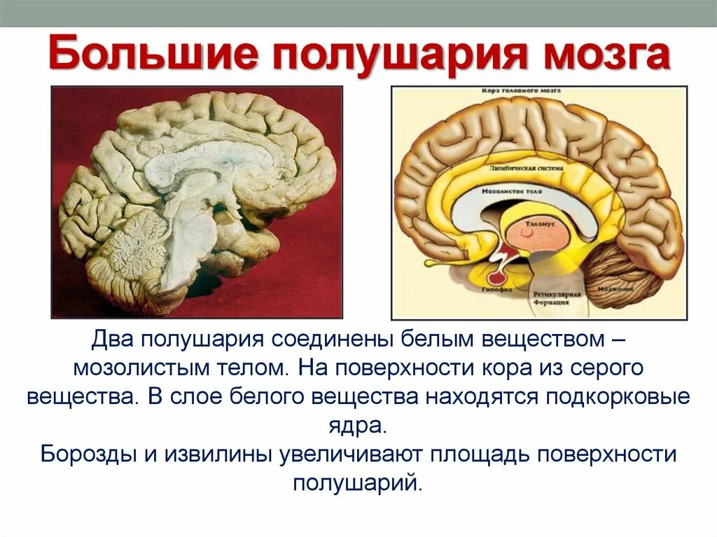 Мозолистое тело больших полушарий. Мозолистое тело базальные ганглии. Большие полушария головного мозга. Анатомия мозолистого тела головного мозга.