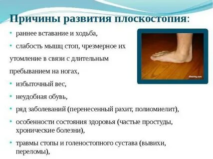 Плоскостопие причины возникновения москва