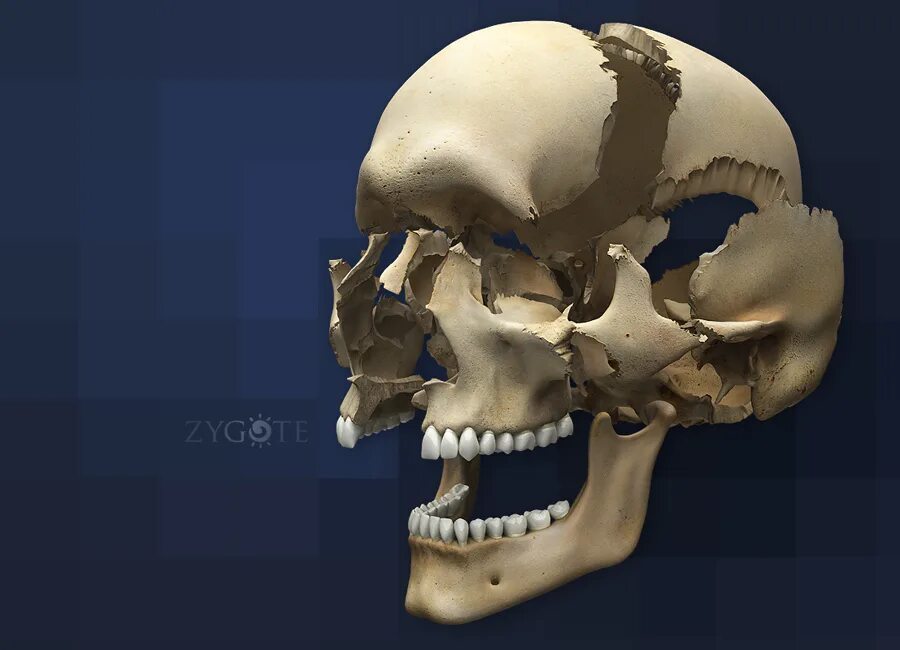 Bone 3d