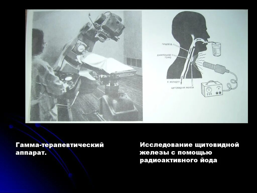 Радиоактивный изотоп йода. Гамма-терапевтический аппарат. Исследование радиоактивным йодом. Исследование щитовидной железы с радиоактивным йодом. Радиоактивные изотопы.