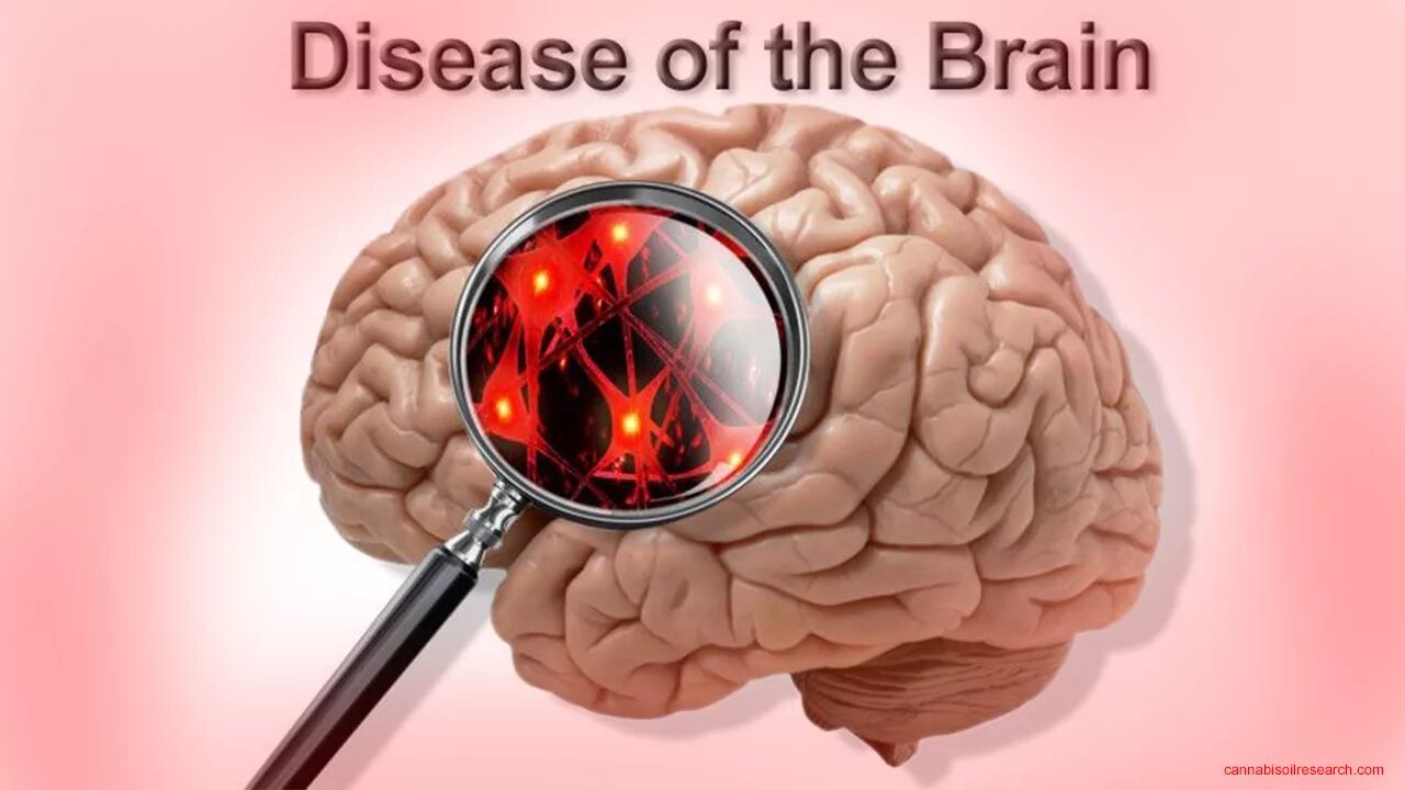 Brain disease. Мозг больного Аспергером.