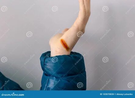 Раненый в руку как пишется н