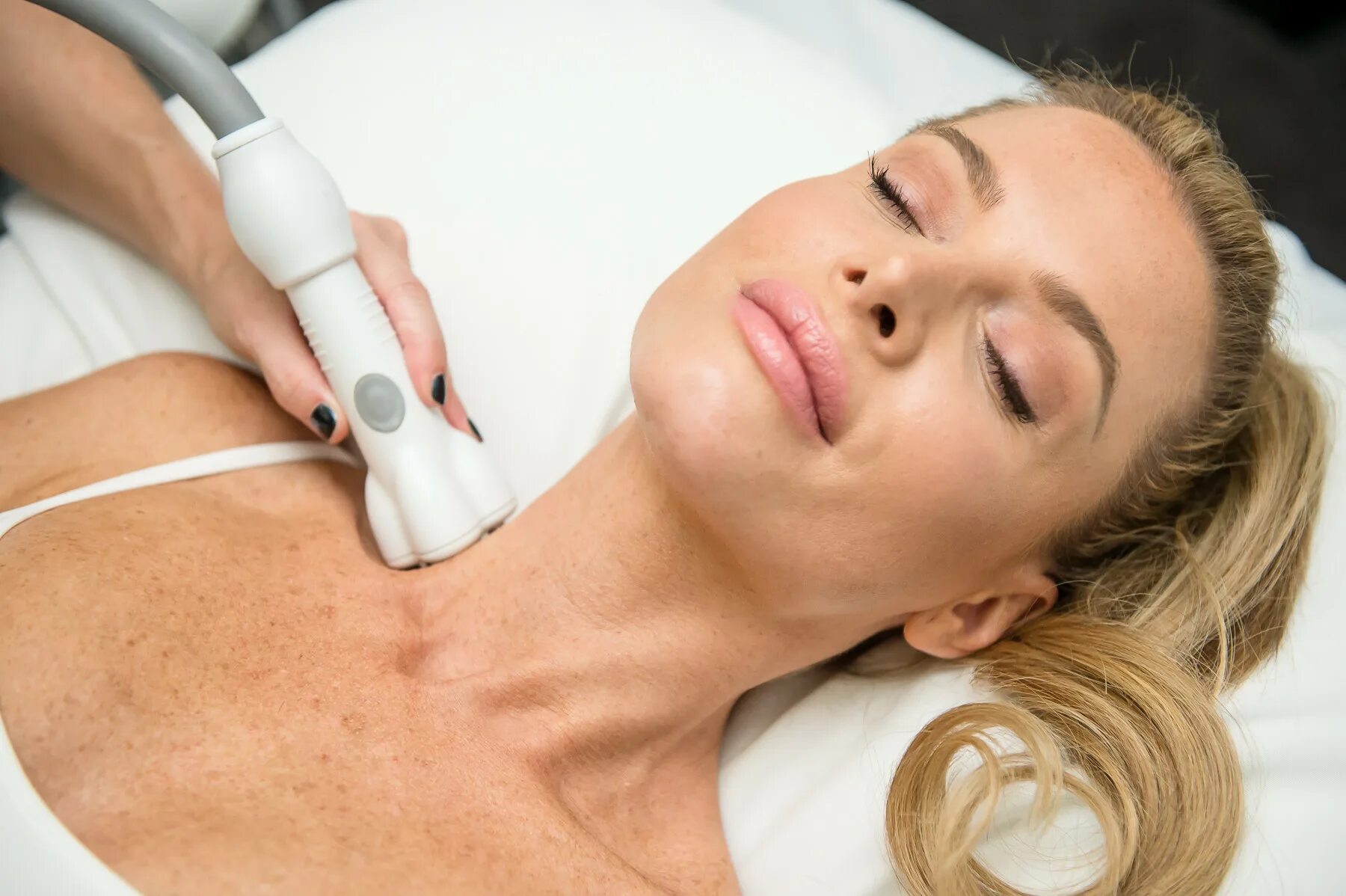 Rf лифтинг для дома. RF-лифтинг. Venus Viva омоложение. Fractional RF treatment.