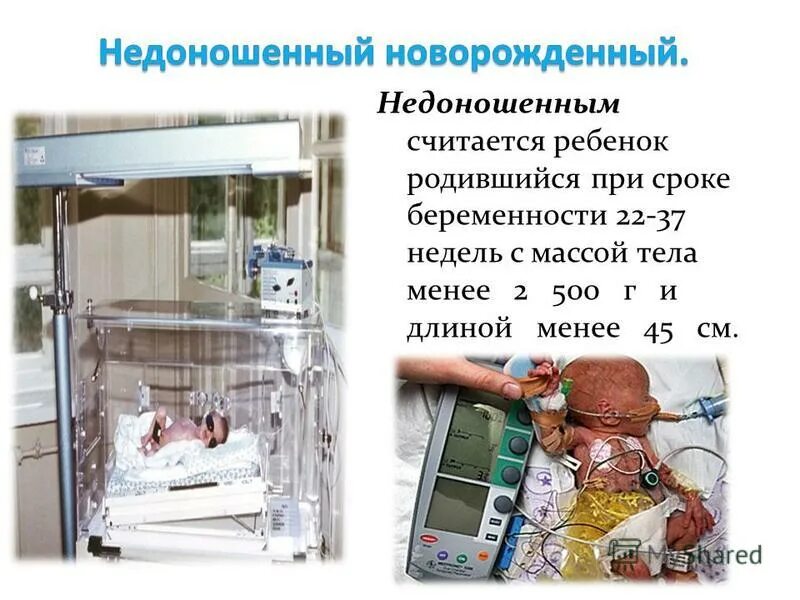 недоношенный ребенок масса тела. дети с экстремально низкой массой тела. недоношенным является ребенок. недоношенным является ребенок родившийся с массой. недоношенным считается ребенок родившийся при сроке гестации.