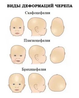 Неправильная форма грудных