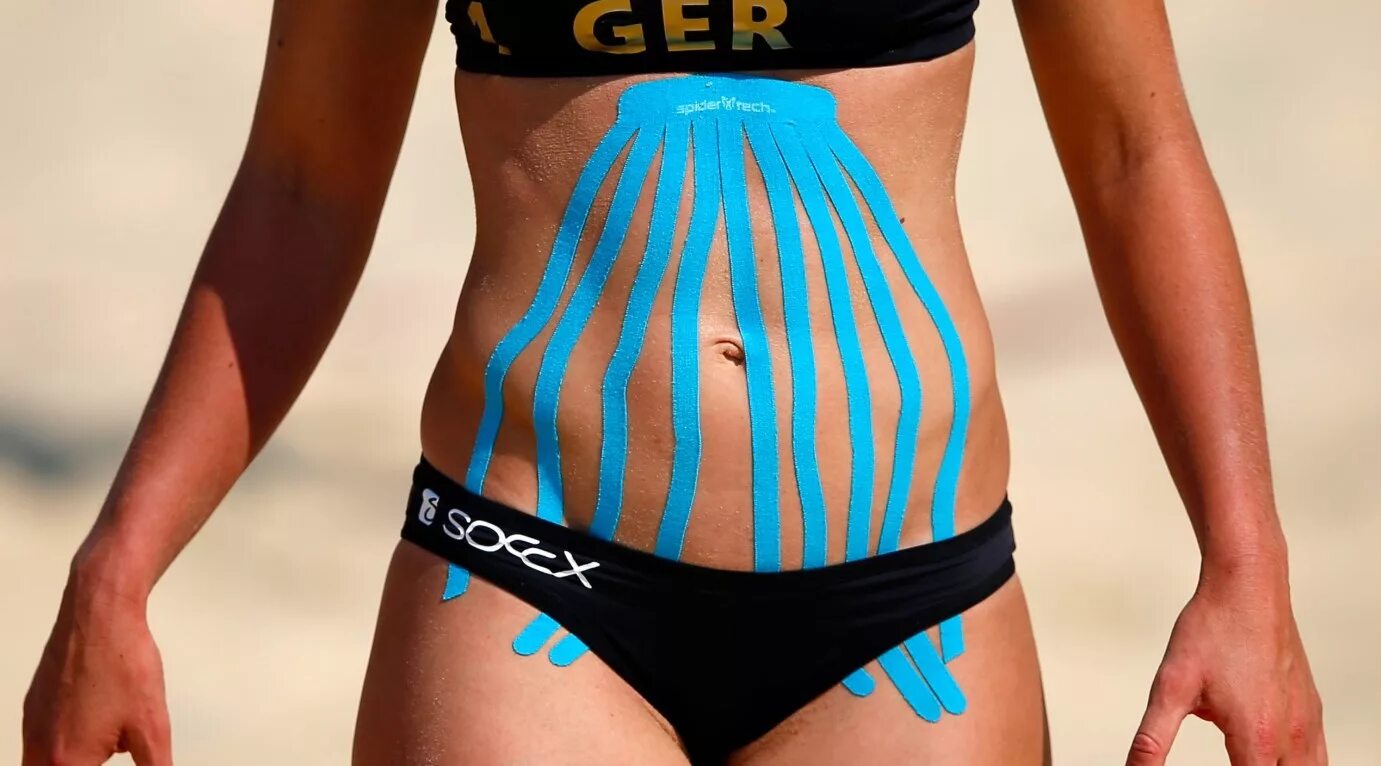 тейпирование живота для подтяжки. фото тейпирования живота. конволюция тейпирование. тейпирование живота и боков. кинезио-тейп лента для похудения.