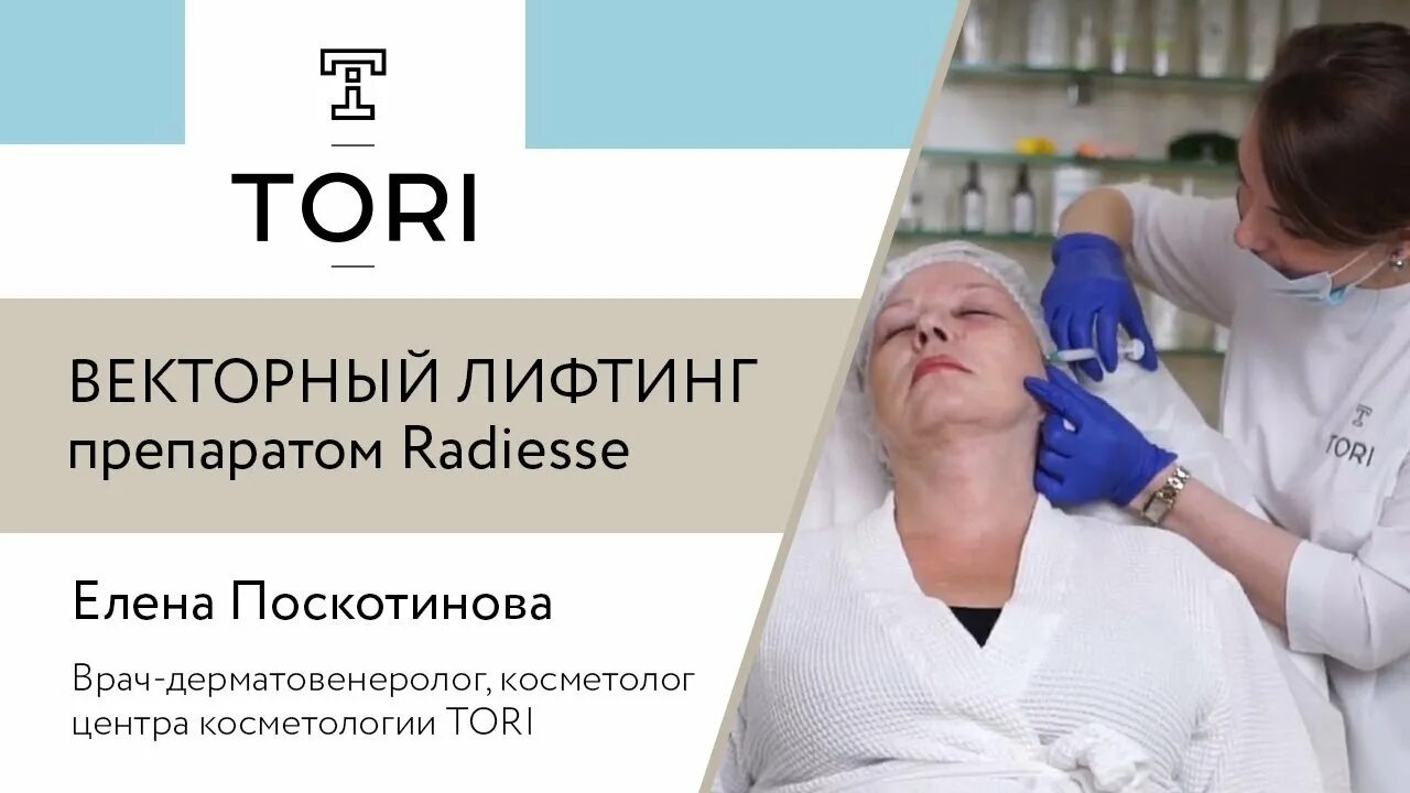 Векторный лифтинг препаратом Radiesse. Лифтинг препарат Радиесс. Радиесс техника введения. Инъекции препаратом Радиесс.