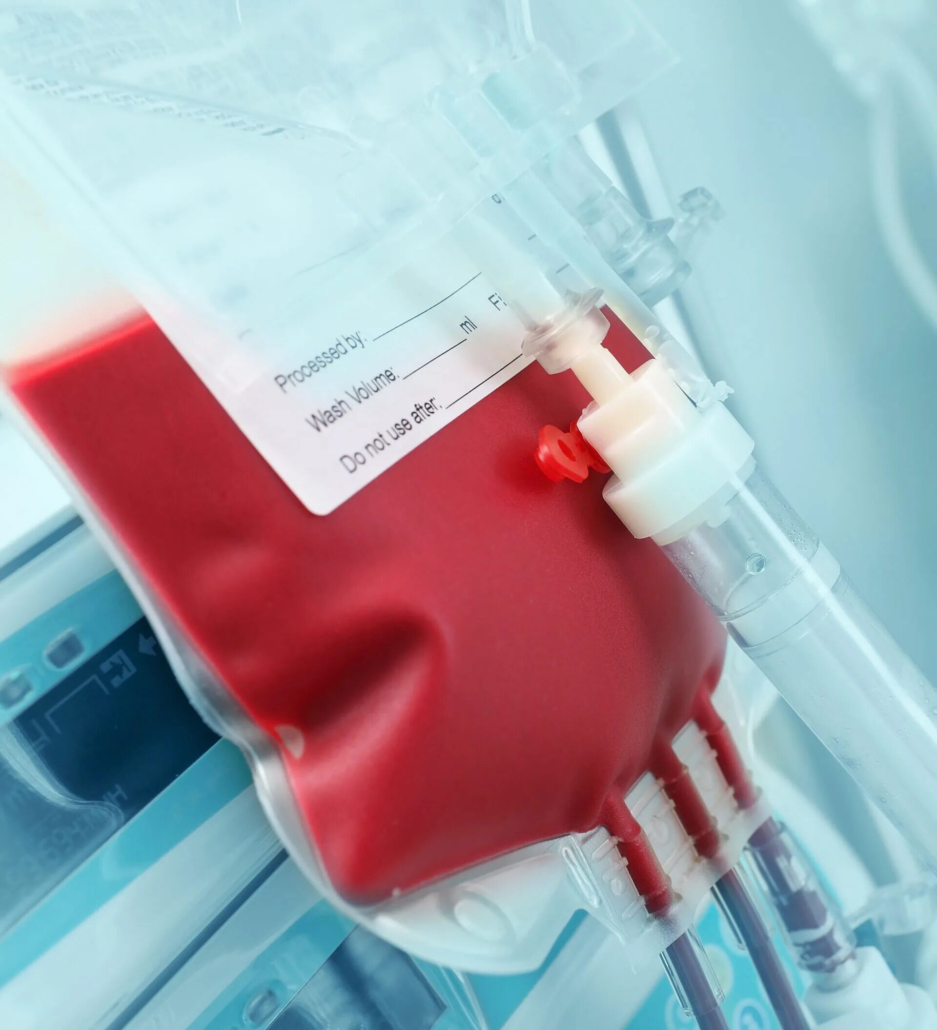Переливание крови при каком гемоглобине. Забор крови для переливания. Ёмкость для сбора крови из вен.